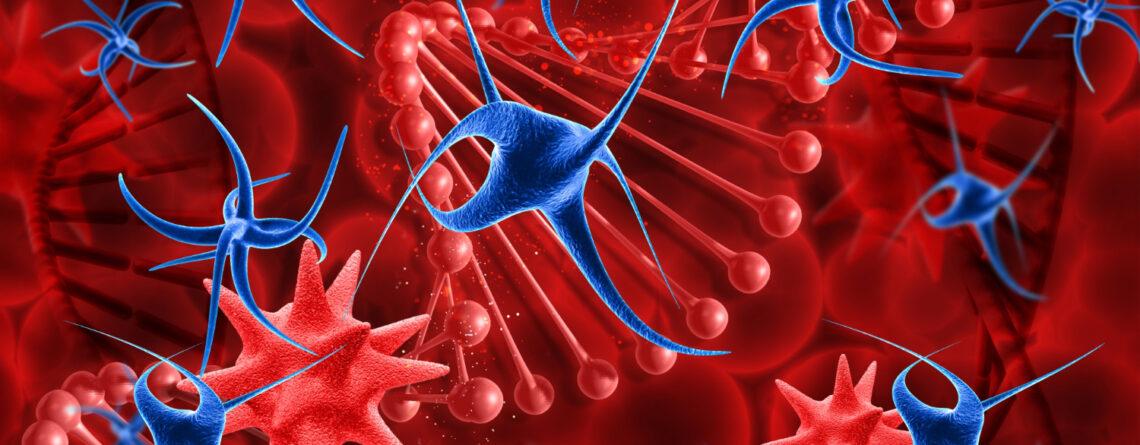 Myelodysplastic syndrome Myelodysplastic syndrome