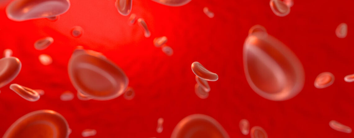 Myelodysplastic syndrome Myelodysplastic syndrome