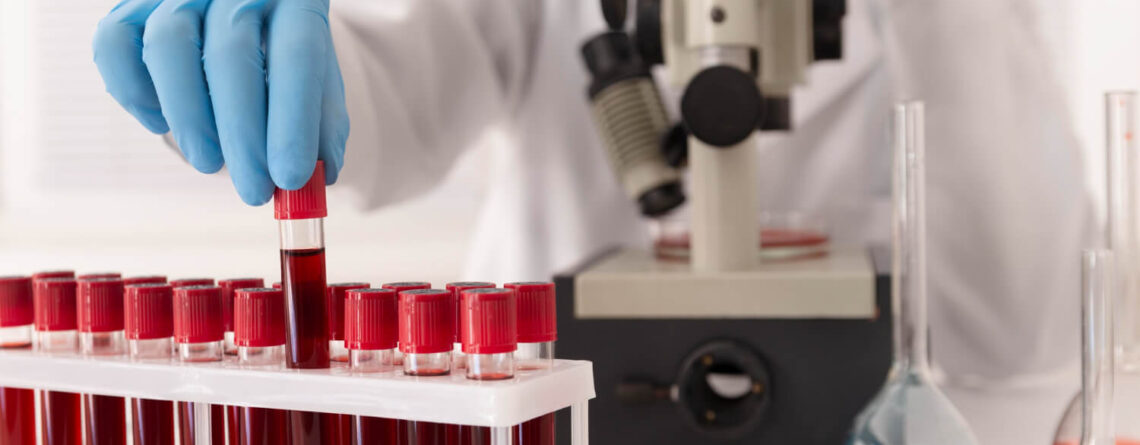 Different types of anemia Different types of anemia