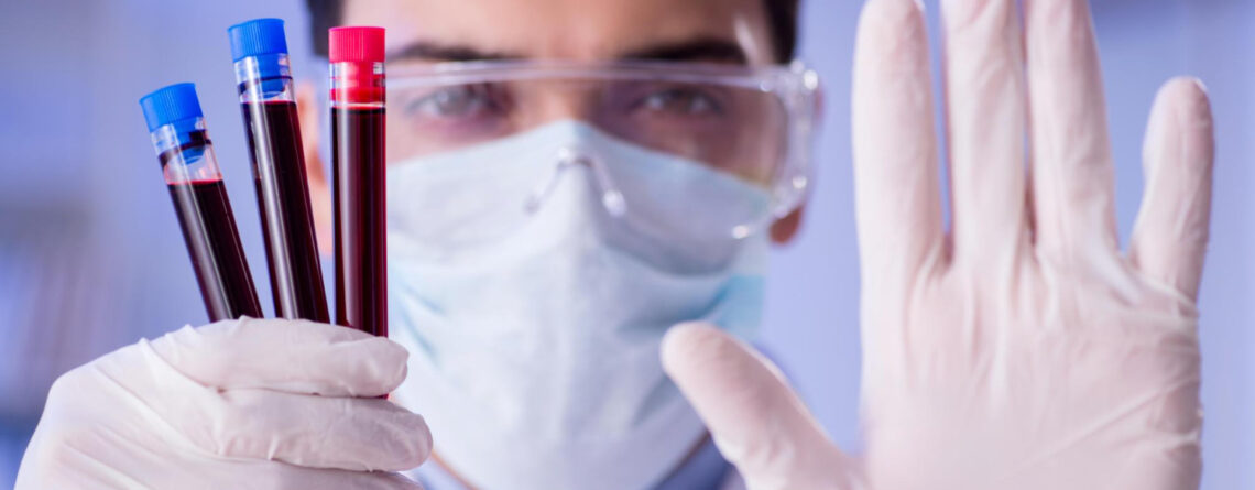 Myelodysplastic syndrome Myelodysplastic syndrome