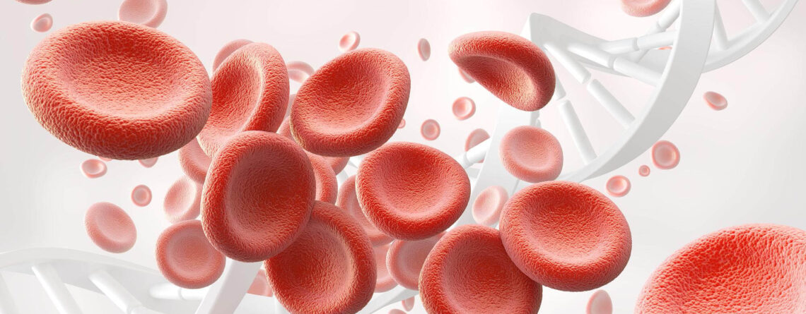 Plasma cell myeloma (plasmacytoma) Plasma cell myeloma (plasmacytoma)