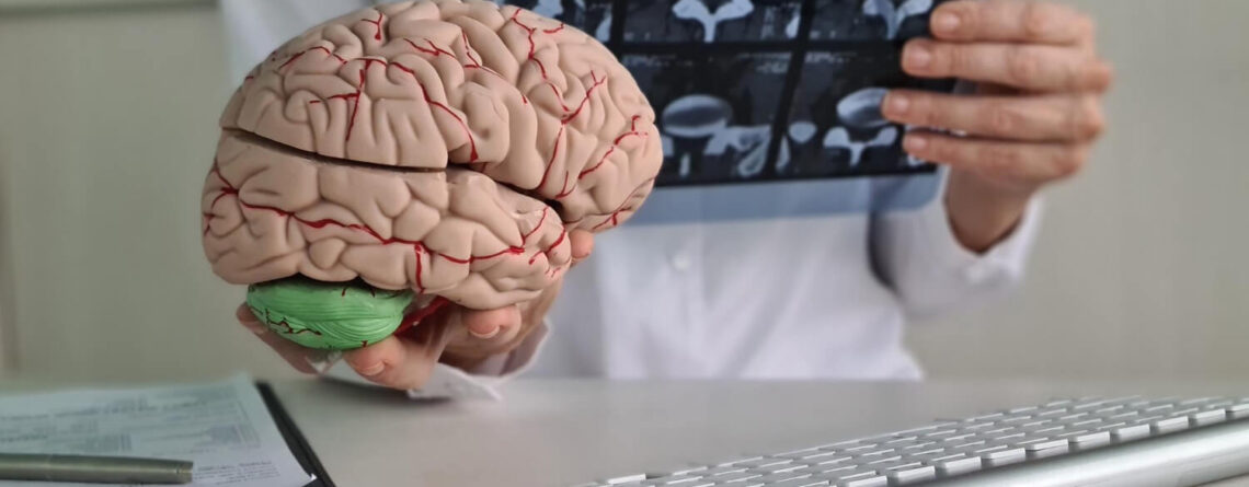 Glioblastoma of the brain in children Glioblastoma of the brain in children
