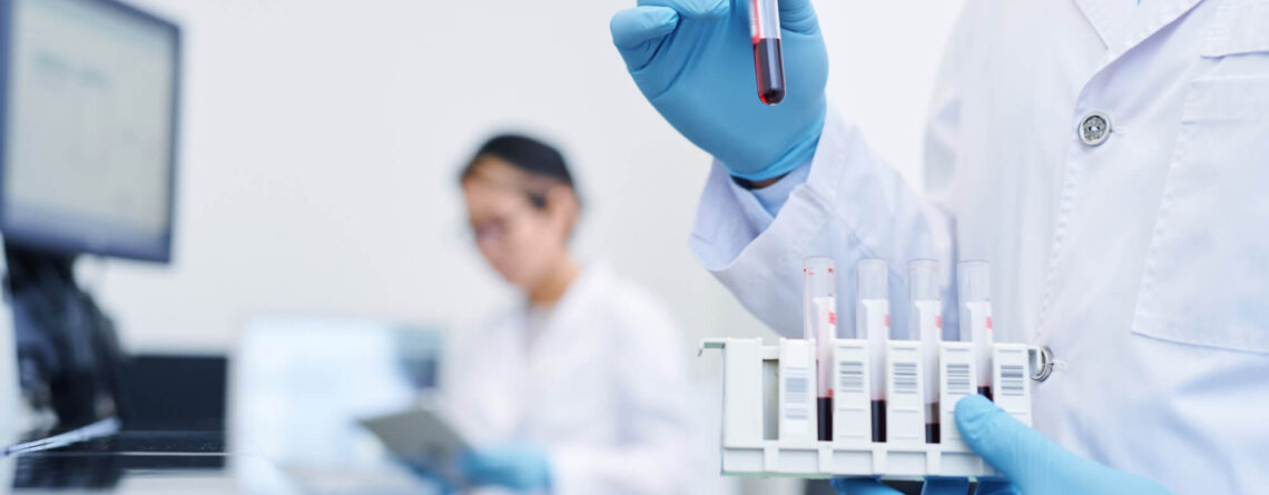 Plasma cell myeloma (plasmacytoma) Plasma cell myeloma (plasmacytoma)