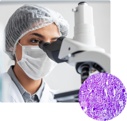 Biopsy and histology